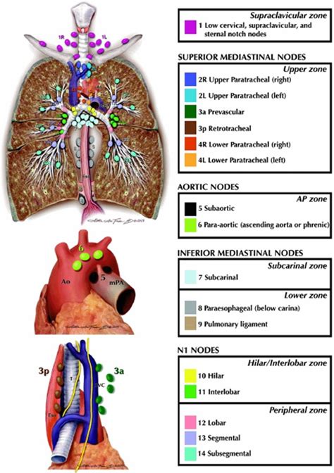 Utilization of the International Association for the Study of Lung ...