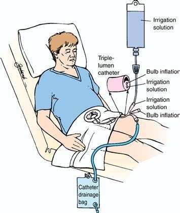 #Compound medicines preferred in the Bladder Irrigation situation. | Pediatric nursing, Nursing ...