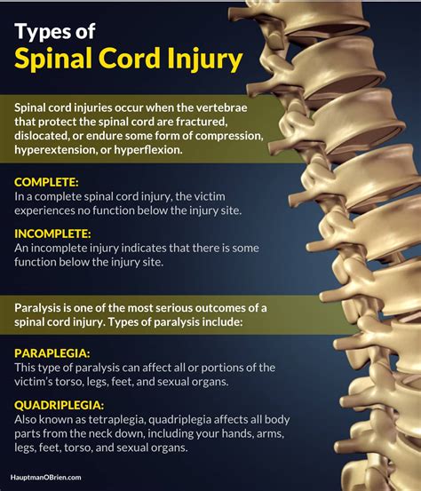 Spinal Cord Injury Lawyers - Sarpy County Injury Law Firm