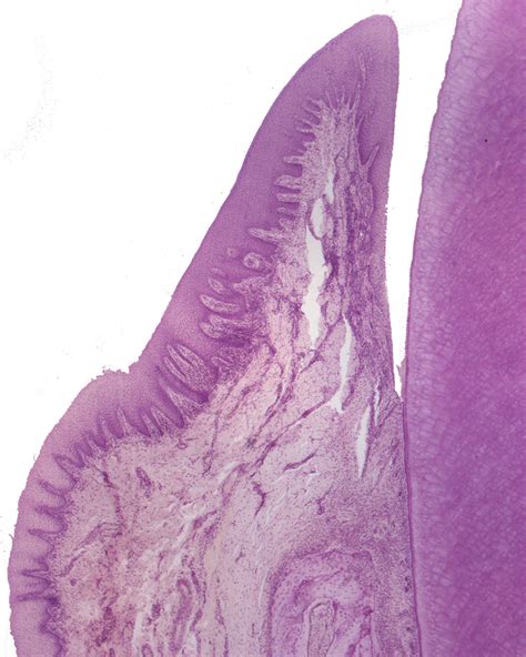 Gingival Sulcus Histology