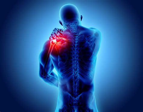 3 Most Common Shoulder Pain Causes and Treatments - iPHYSIO Blog