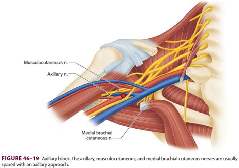 Upper Extremity Peripheral Nerve Blocks: Axillary Block