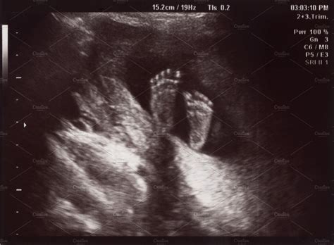 Ultrasound Sonogram: Baby's Feet | People Images ~ Creative Market