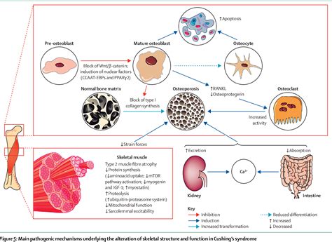 [PDF] Complications of Cushing's syndrome: state of the art. | Semantic Scholar