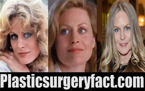 Beverly D Angelo Plastic Surgery 2015 Photos | Plastic surgery, Plastic ...