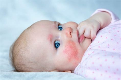 Caring for Baby Rash on Stomach: A Parent's Guide - BLDG Active