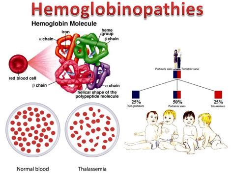 Hemoglobinopathy Market is Touching New Development Level |Nexcelom Bioscience, Nihon Kohden ...