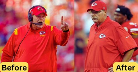 Is Andy Reid Weight Loss and Scored Big with Weight Reduction? - Talkxbox