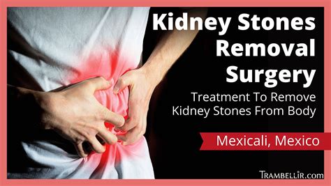 Kidney Stone Treatment Home