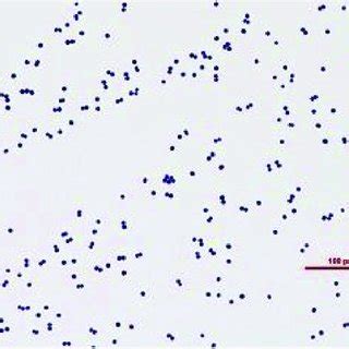 (PDF) Staphylococcus saprophyticus native valve endocarditis possibly ...