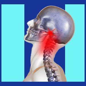 TMJ Neck Pain - Neck Pain