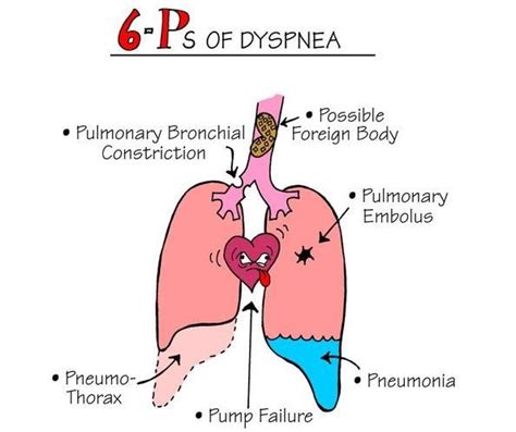 Dyspnea | Nursing mnemonics, Nursing education, Nursing school