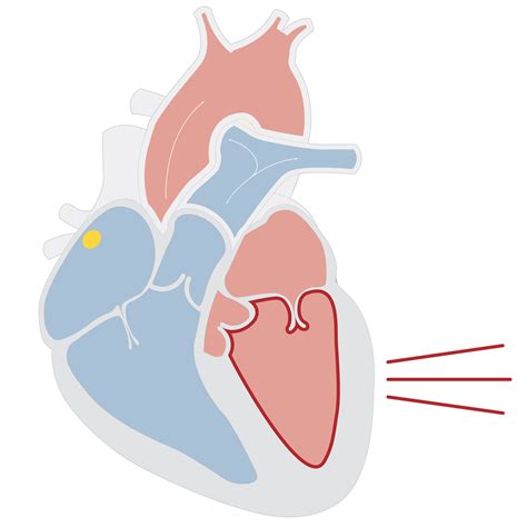 Commotio Cordis: The Rare Heart Phenomenon Thought to Have Caused Damar Hamlin’s Collapse - WSJ