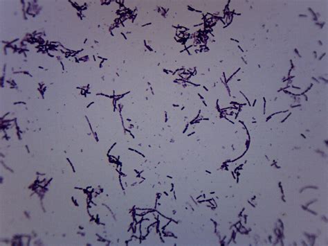 Prepared slide of azotobacter. Gram negative stain Azotobacter species ...