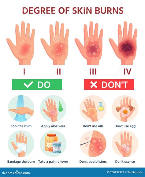 Skin Burn Severity Chart