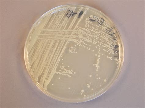 Image - Enterobacter aerogenes.JPG | Classroom Bacterial Identification Wiki | FANDOM powered by ...