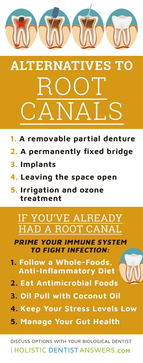 Infographic: "Alternatives to Root Canal" | Root canal, Holistic ...