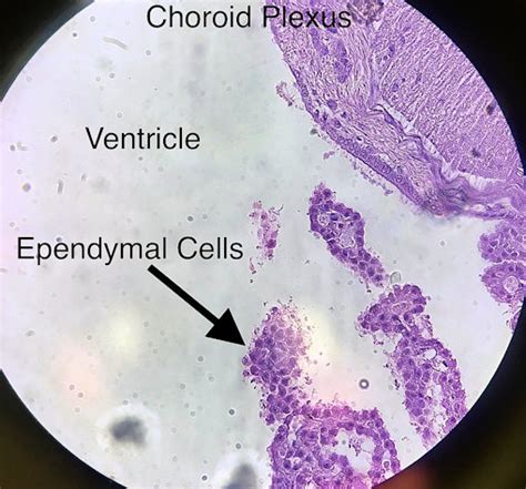 Ependymal cell and the choroid plexus histology