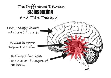 Brainspotting - Equinox Therapy