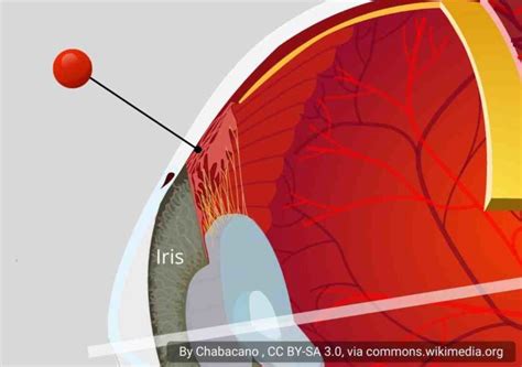 Anatomy of the Eye (Part 2) - Master Medical Terms