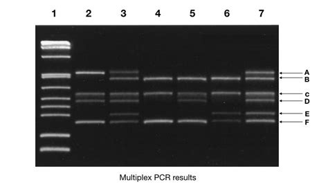 The Electrophoresis Results Best Support Which of the Following