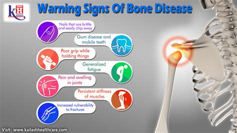 Types Of Bone Disease | Hot Sex Picture