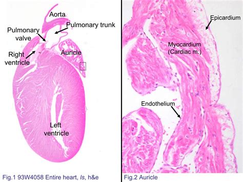 Structure Of Heart Wall : Block3 Fig 1 93w4058 Entire Heart Ls H E - Jubir Tahunan