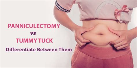 Panniculectomy vs. Tummy Tuck - What are the Key Differences