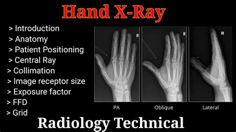 X-ray Image Of Hand, Oblique View, Stock Image Image Of, 45% OFF