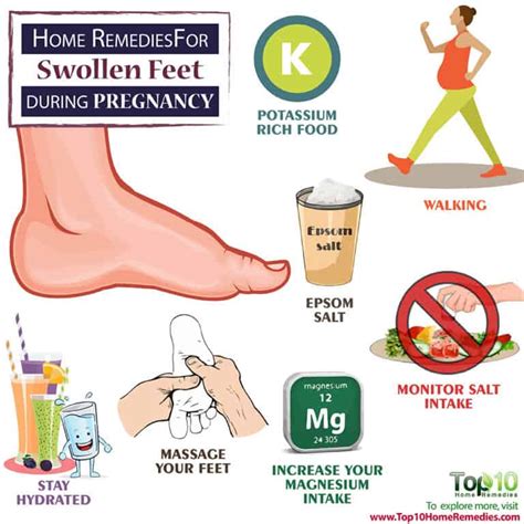 Home Remedies for Swollen Feet during Pregnancy | Top 10 Home Remedies