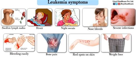 Chronic Lymphocytic Leukemia Symptoms