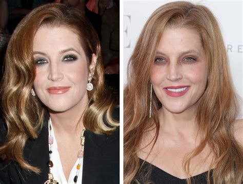 Lisa Marie Presley Before and After Plastic Surgery