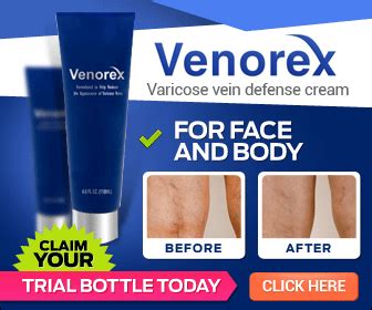 Venorex Varicose Vein Cream Reviews - VeinsNet