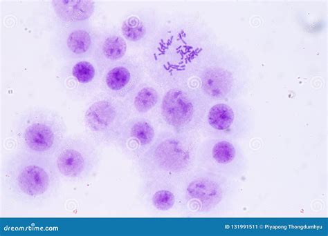 Human Chromosomes Under Microscope