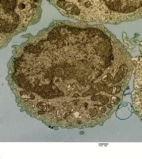 Human B Lymphocyte | Transmission electron micrograph of a B… | Flickr