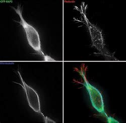 Focusing on TIRF Microscopy | Features | Jul 2003 | Photonics Spectra