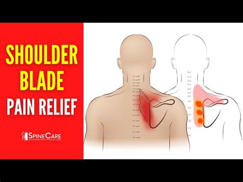 Possible Causes Of Pain Under Your Shoulder Blade, 49% OFF