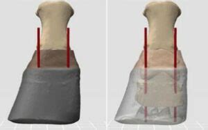 Learning The Bone Referenced Trim | EponaMind