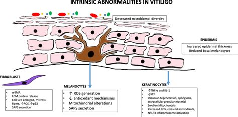 Vitiligo Types - VitiligoHub