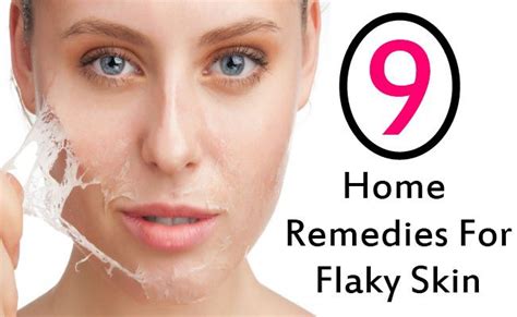 9 Home Remedies To Get Rid Of Flaky Skin | GilsCosmo.com - Shopping ...