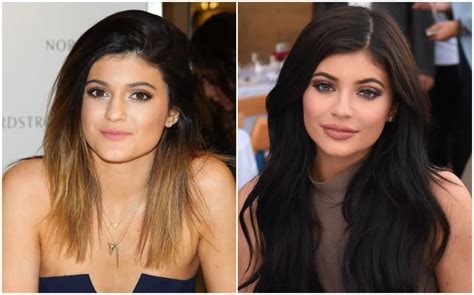 Kylie Jenner After & Before Pictures: Did She Do Surgery? - Demotix.com