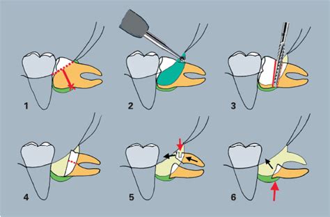 9. The horizontal third molar | Pocket Dentistry