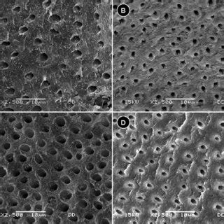 Density and diameter of the dentin tubules by SEM. A. Dentin tubules of... | Download Scientific ...