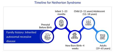 Insights into the Emerging Netherton Syndrome Treatment Options