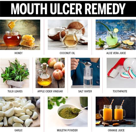 How To Relieve Mouth Ulcer Pain - Plantforce21