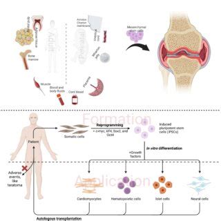 Sources and application of mesenchymal stem cells (A) and induced ...