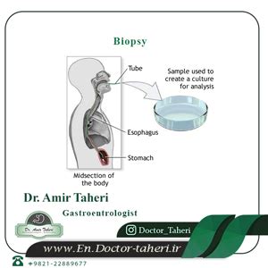 biopsy | types of biopsy | biopsy recovery