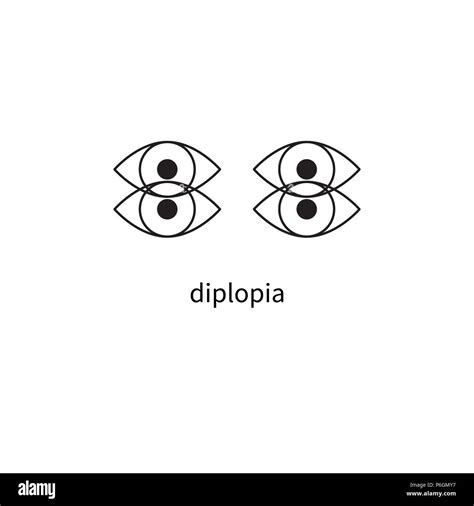 Diplopia sign, double vision, icon diplopia, dizziness Stock vector ...