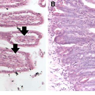 Histology of representative tissue specimens of the terminal ileum ...