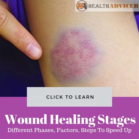 Photos Of Wound Healing Stages